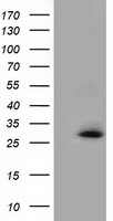Glutathione S Transferase theta 2 Antibody