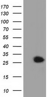 Glutathione S Transferase theta 2 Antibody