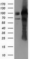 PUS7 Antibody