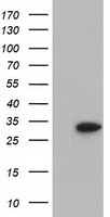 SULT2A1 Antibody