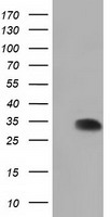 SULT2A1 Antibody