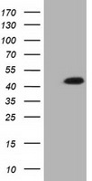 IVD Antibody
