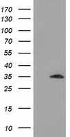 SULT2A1 Antibody