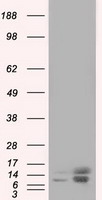 PFN1 Antibody