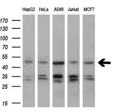 IGBP1 Antibody