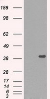 DNTTIP1 Antibody