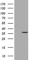 CAPZA1 Antibody