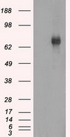 BTK Antibody