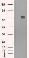 BTK Antibody