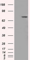 BTK Antibody