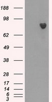 BTK Antibody