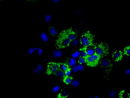 Aconitase 2 Antibody