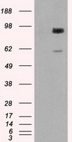 GBE1 Antibody