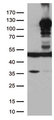 LEMD3 Antibody