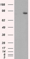 GBE1 Antibody