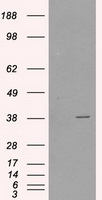 Sorbitol Dehydrogenase Antibody