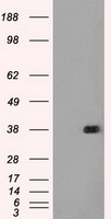 FCGR2A Antibody