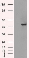 Glucose Transporter 5 GLUT5 Antibody