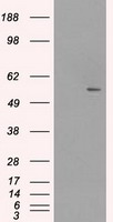 Glucose Transporter 5 GLUT5 Antibody