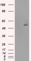 Glucose Transporter 5 GLUT5 Antibody