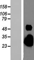 Plaur (BC010309)Mouse Over-expression Lysate