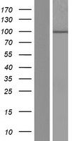 DCDC5 Human Over-expression Lysate