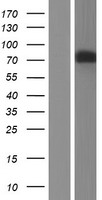 PDE4D Human Over-expression Lysate