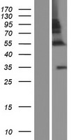 ZNF783 Human Over-expression Lysate