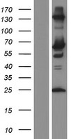 Sterol carrier protein 2 (SCP2) Human Over-expression Lysate