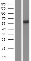 Glutathione Reductase (GSR) Human Over-expression Lysate