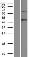 PSMA (FOLH1) Human Over-expression Lysate