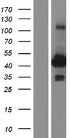 Aminoacylase 1 (ACY1) Human Over-expression Lysate