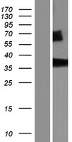 NIT1 Human Over-expression Lysate