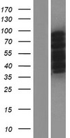 CPEB3 Human Over-expression Lysate