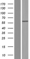 Alkaline Phosphatase (ALPL) Human Over-expression Lysate