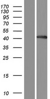 BHMT2 Human Over-expression Lysate