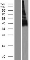 LY108 (SLAMF6) Human Over-expression Lysate