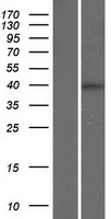 CD84 Human Over-expression Lysate