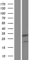 DNAAF6 Human Over-expression Lysate