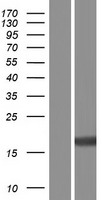 TRAPPC1 Human Over-expression Lysate