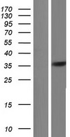 FYTTD1 Human Over-expression Lysate
