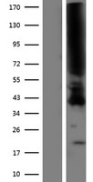 PAF Receptor (PTAFR) Human Over-expression Lysate