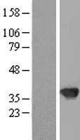 TBX20 Human Over-expression Lysate
