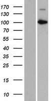 CARNS1 Human Over-expression Lysate