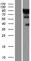ZC3H14 Human Over-expression Lysate