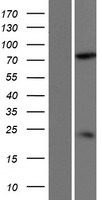 DDHD2 Human Over-expression Lysate