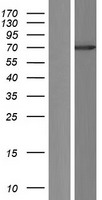 HDAC10 Human Over-expression Lysate