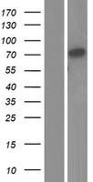 Lactoperoxidase (LPO) Human Over-expression Lysate