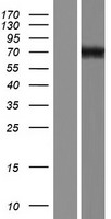 Glypican 3 (GPC3) Human Over-expression Lysate