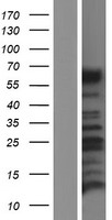 Calcitonin receptor (CALCR) Human Over-expression Lysate
